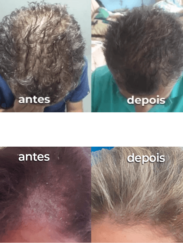 antes x depois - portugal